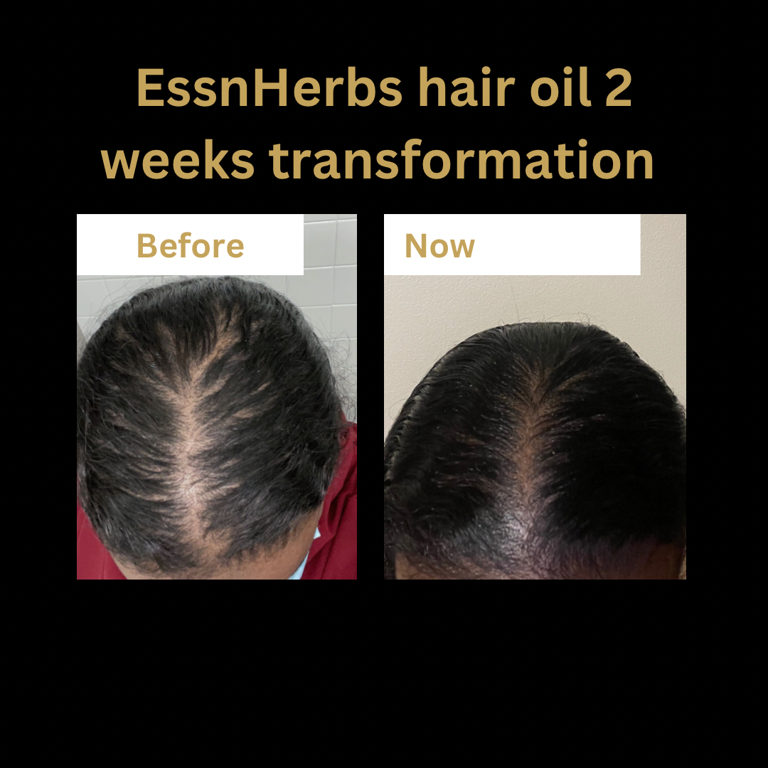 EssnHerbs Hair Oil